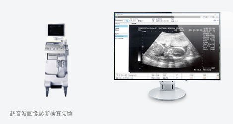 E-Egg 検査結果取り込み4